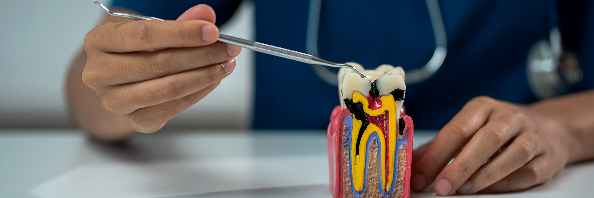 canter bury root herobanner