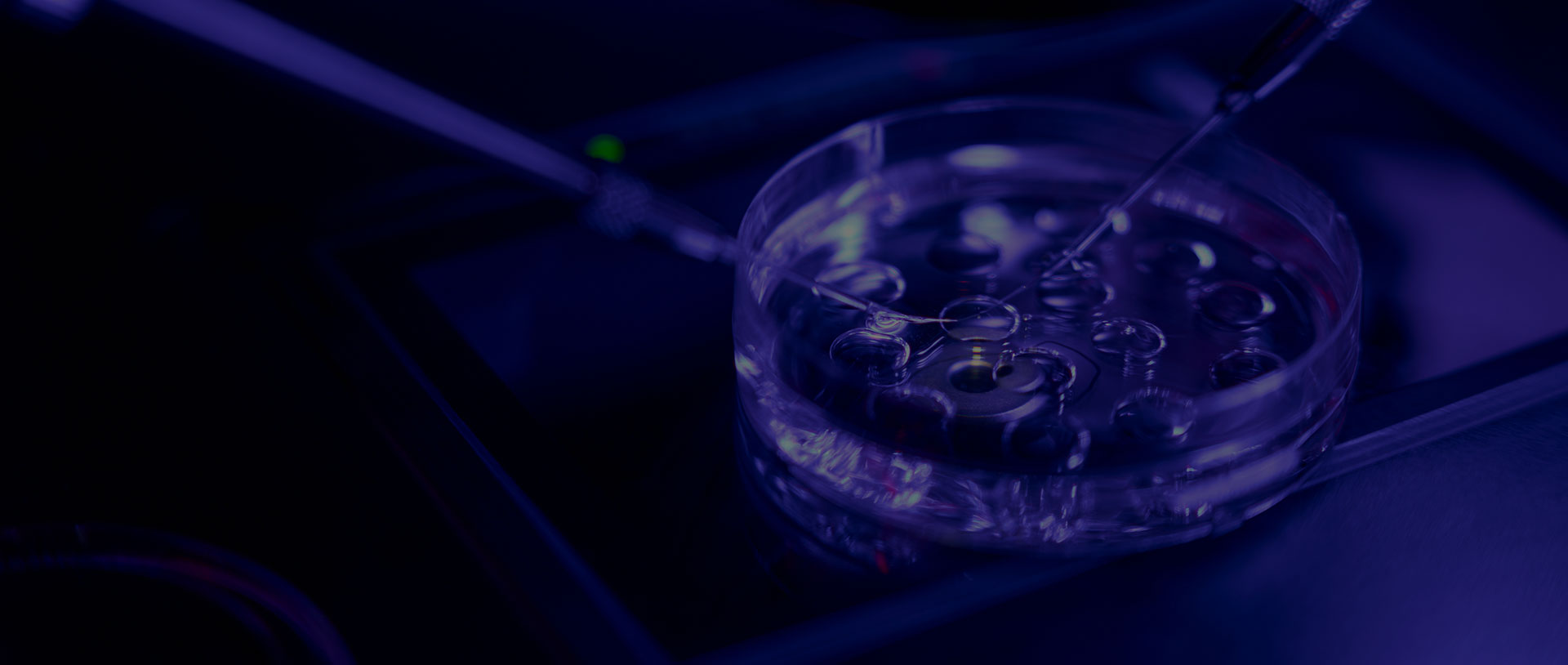 ivf1