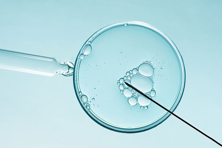 ivf2