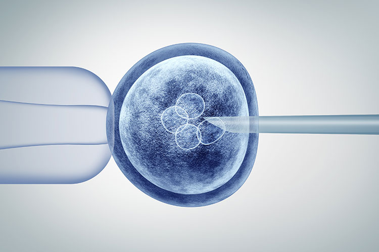 ivf3